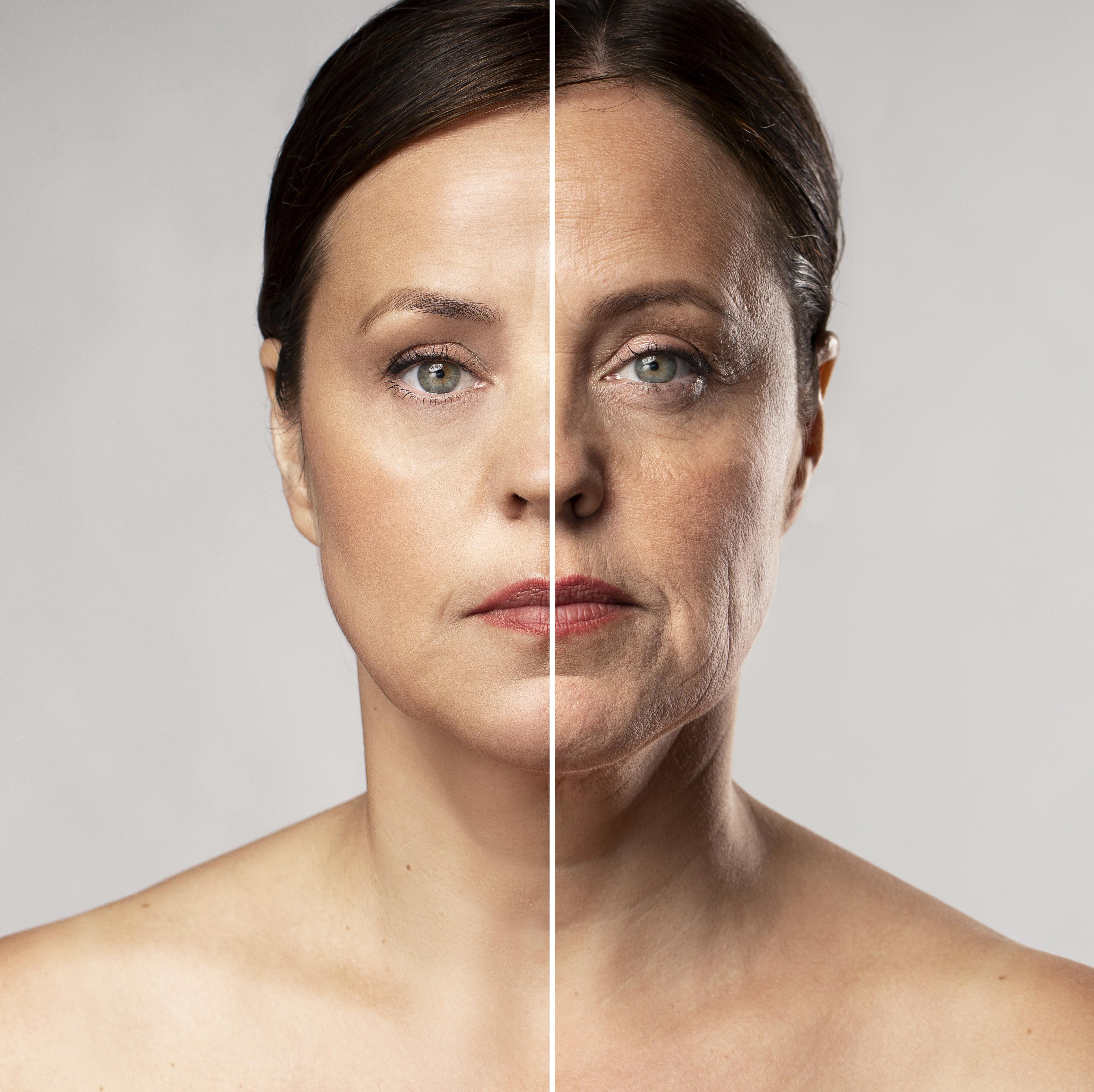 Imagem do procedimento de Botox